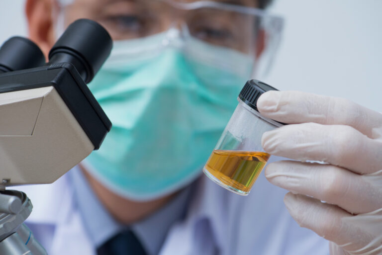 Fake Pee For Drug Test? 5 Reasons NEVER To Use One Anaheim Lighthouse