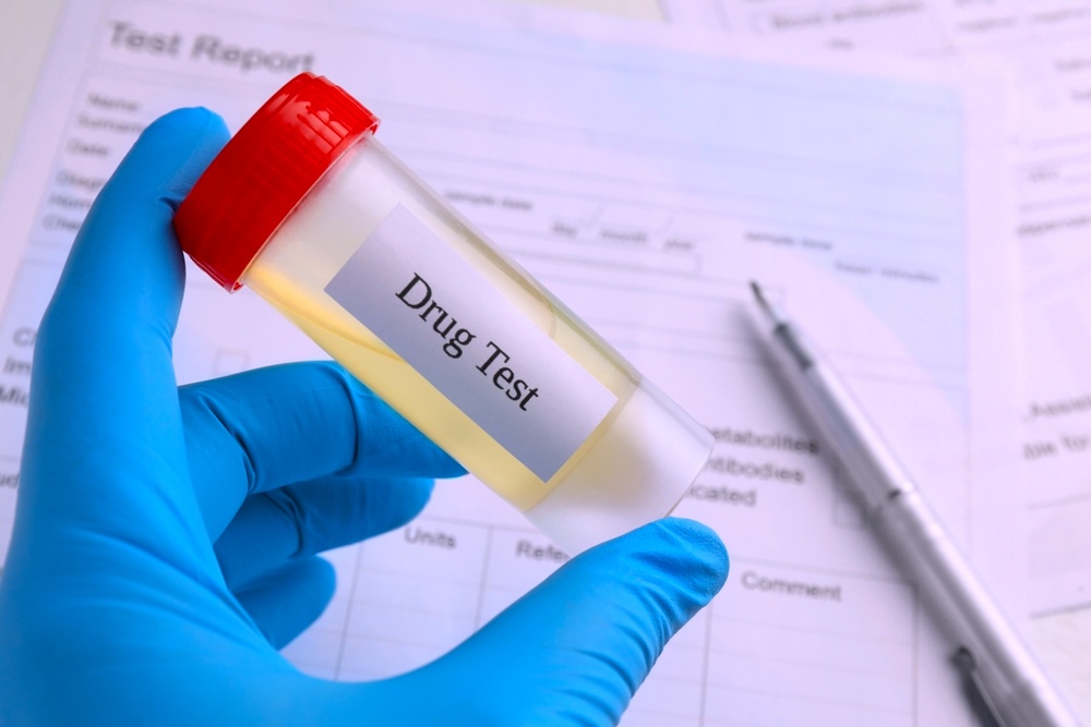 Small vial of urine for meth drug testing